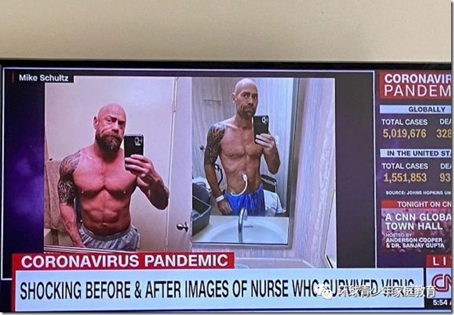 前天半夜3点钟肚子右边下腹疼，一直身体额头冒汗不停，才知道生命和健康珍贵，没事千万不要感染非典和新冠病毒，新冠后遗症很严重，要付出生命代价才结束！